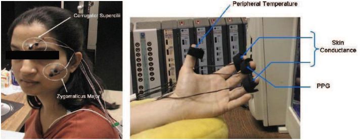 affective computing sensors autism myofacial PPG EMG